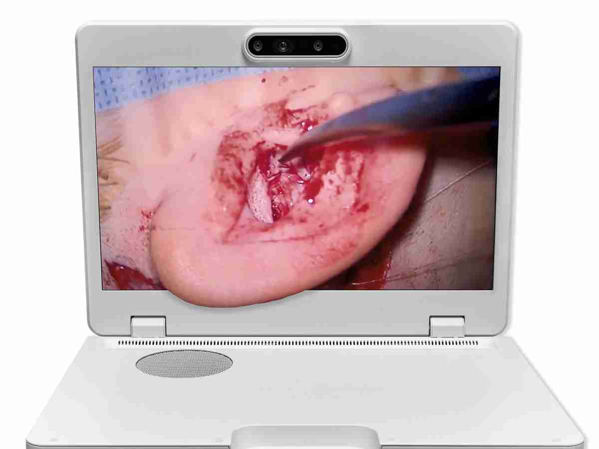 达擎之＂Heads-up 3D显微手术显示系统＂，，，整合4K裸眼3D显示及眼球追踪系统，，，，具备快速追踪人眼移动位置功能，，减轻医师长时间维持固定姿势的负担，，，，让医师能有更宽广清晰的3D立体视野及更舒适的姿势来执行手术。。。